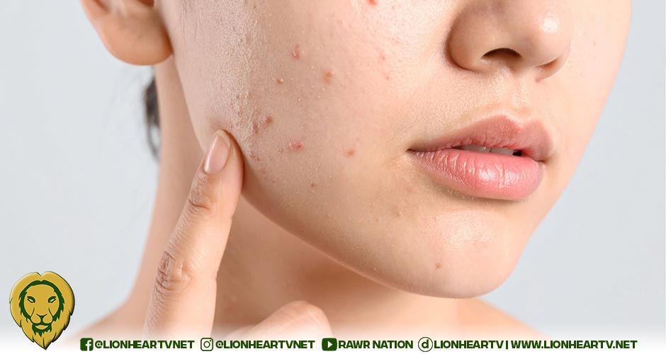 Bare glowing summer skin by looking out for these common skin woes